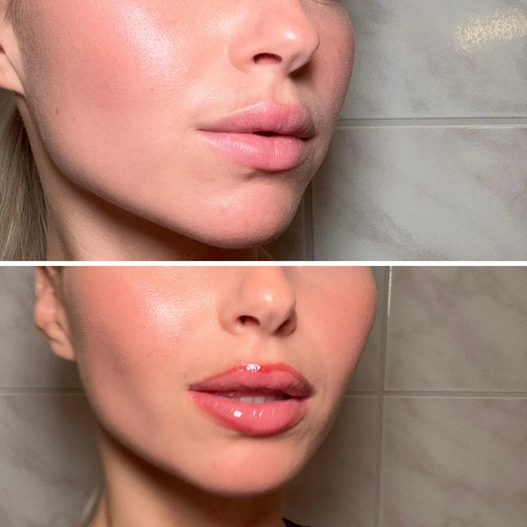 Lamel Stain Hydrating Lip Gloss | 2-in-1 Gloss & Long-Lasting Lip Stain