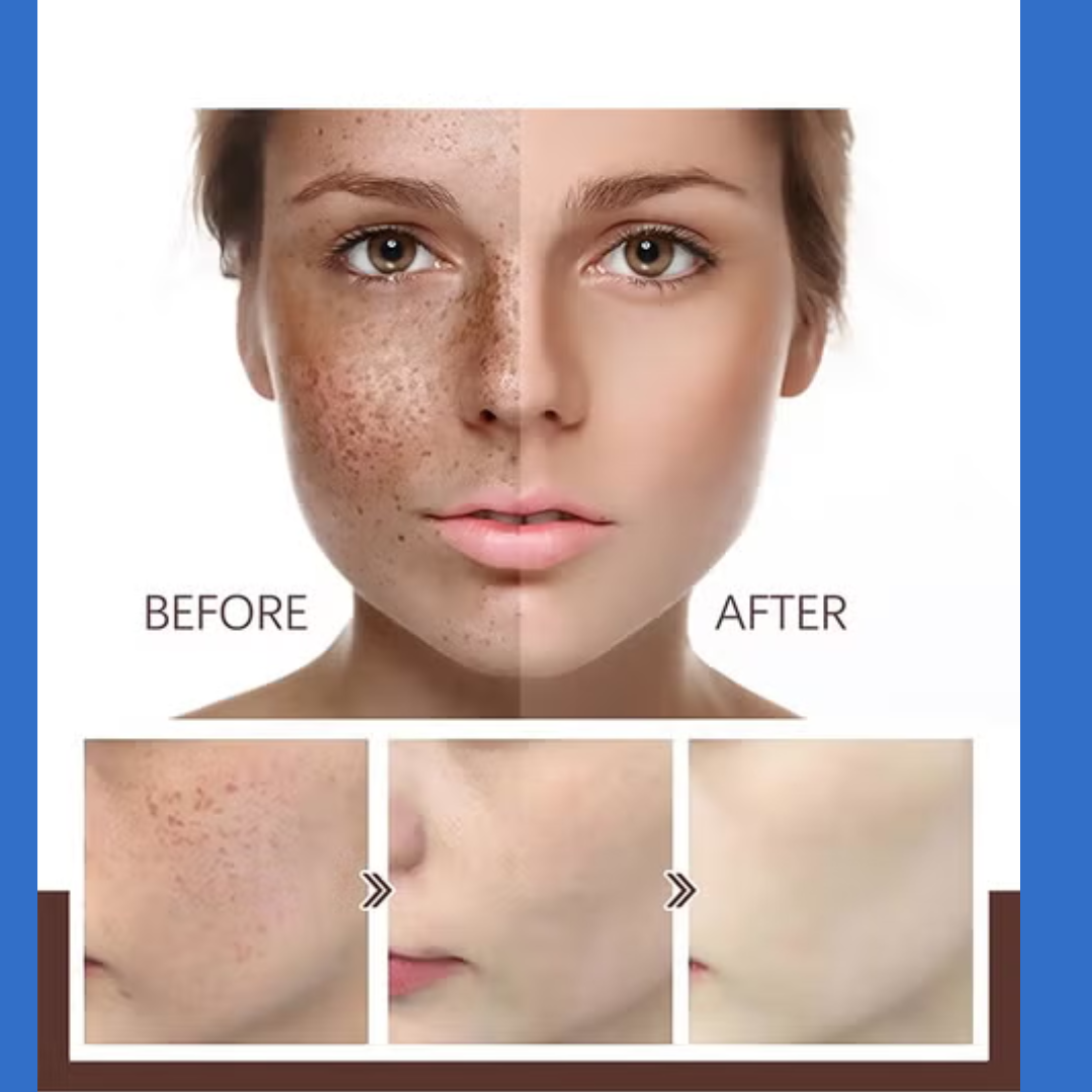 Suroskie peel off mask | cleanse & tighten pores | Glass like Skin in 20 minutes