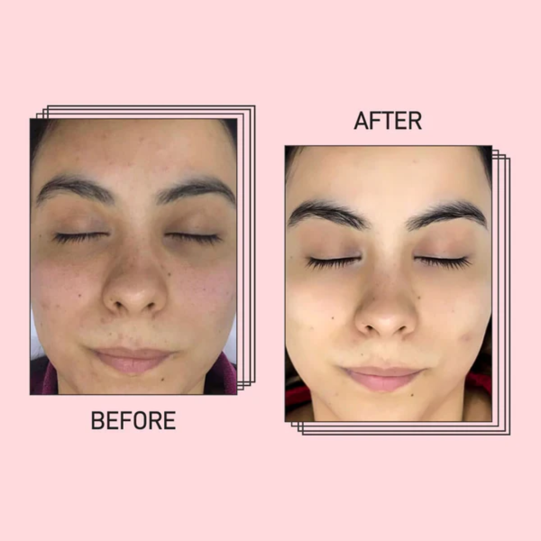 Skin Brightening Instant Facial Mask - Remove tan & Dull skin in just 5 minutes