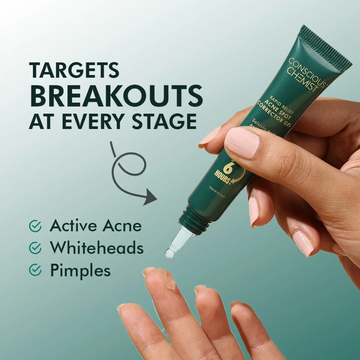 Conscious Chemist Acne Relief Gel | Reduces Pimples Fast | Controls Oil | Calms Redness