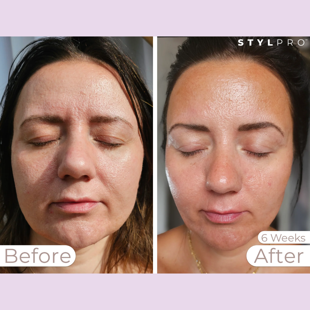 Skin Brightening Instant Facial Mask - Remove tan & Dull skin in just 5 minutes