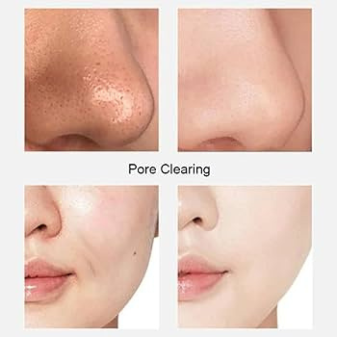 Suroskie peel off mask | cleanse & tighten pores | Glass like Skin in 20 minutes