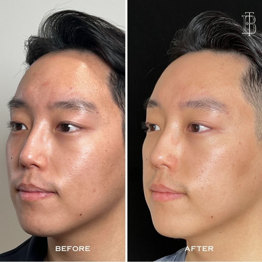 Plix Youth Renewal Night Cream | Reduces Wrinkles, Boosts Collagen & Deeply Hydrates