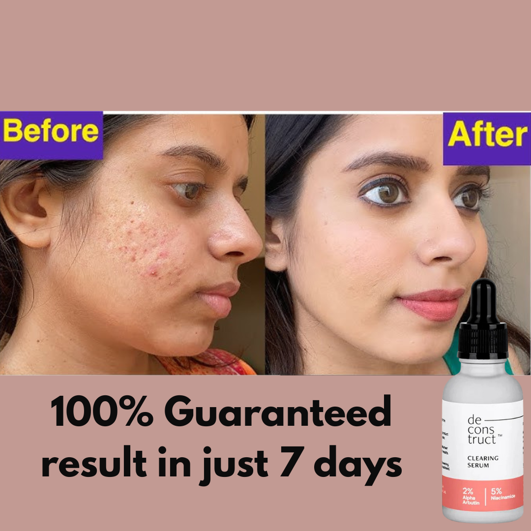Deconstruct Clearing Serum - Remove Pigmentation & dark spots in just 7 days - Guaranteed Results