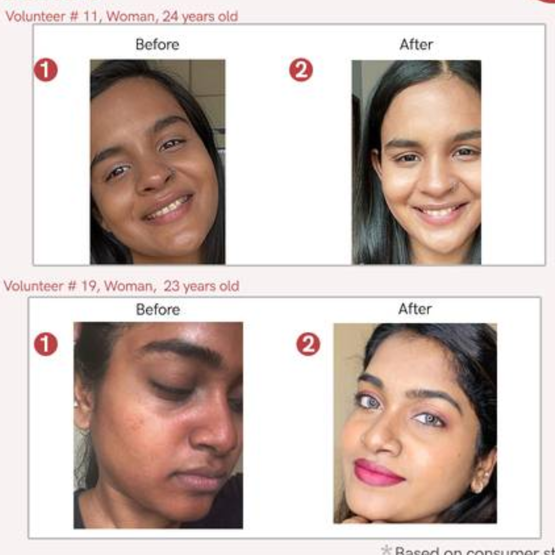 Skarfix-Plus Brightening Body Wash | 4% actives to cleanse, brighten, and fade dark spots - Instant DeTan Solution