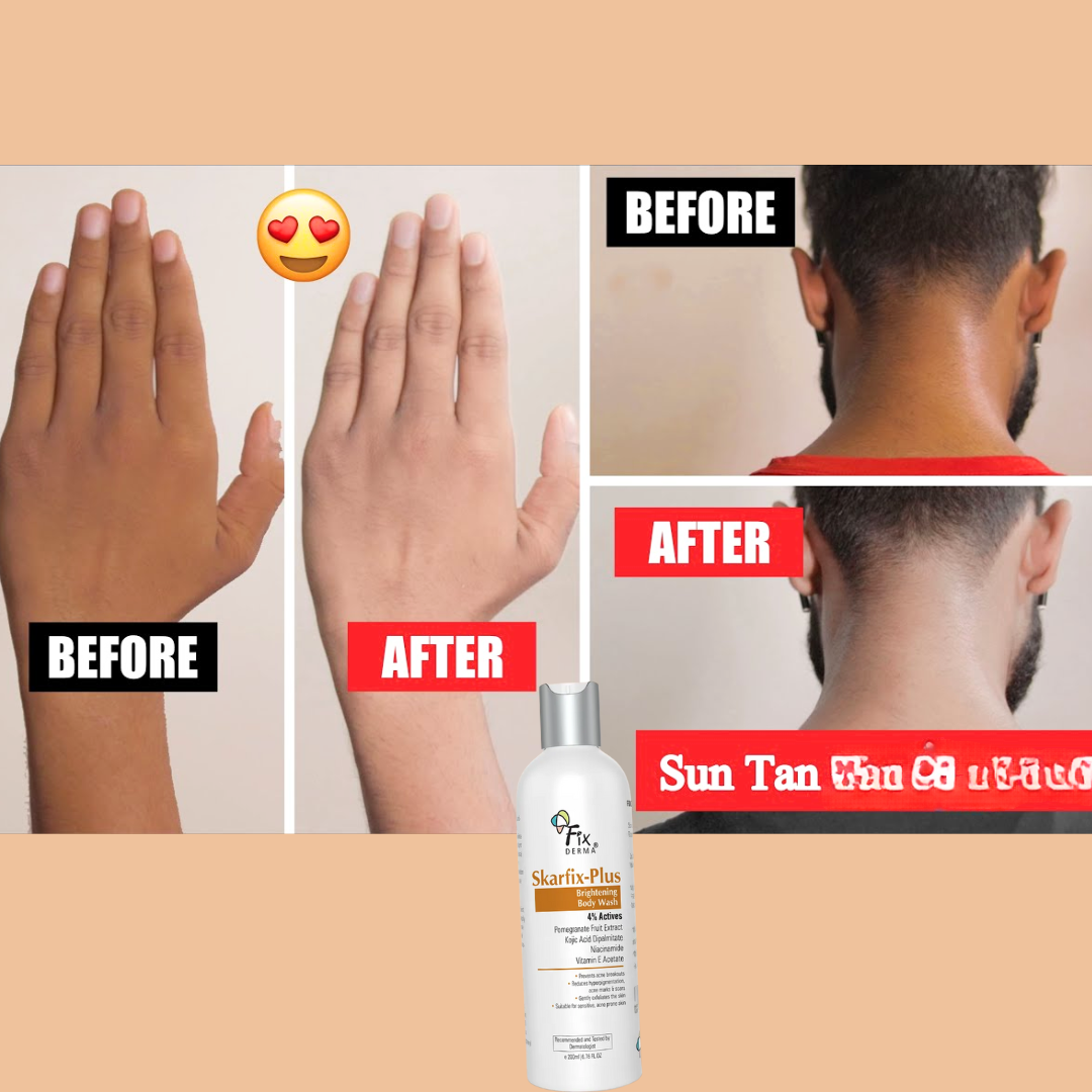 Skarfix-Plus Brightening Body Wash | 4% actives to cleanse, brighten, and fade dark spots - Instant DeTan Solution