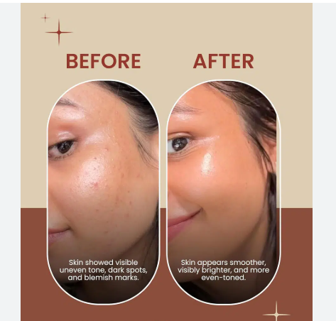 Deconstruct Clearing Serum - Remove Pigmentation & dark spots in just 7 days - Guaranteed Results